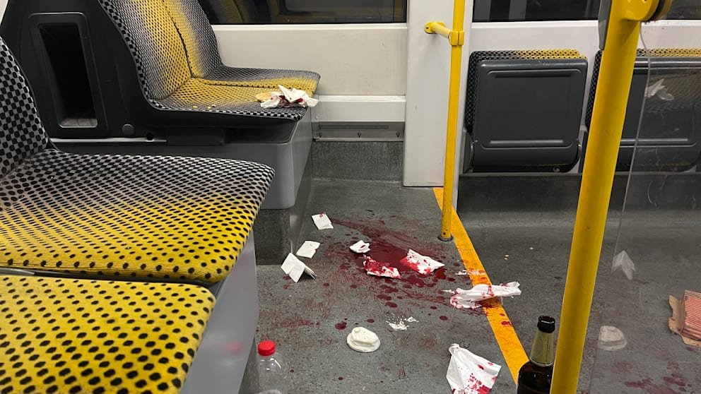 Az amerikai állampolgár az arcába szúrta Németországban, Weidel hibáztatja a CDU -t